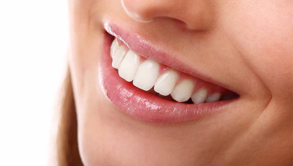 Lucariello Odontoiatria - Come avere denti bianchi