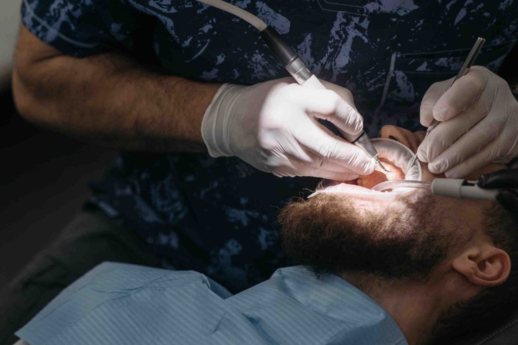 Lucariello Odontoiatria - Dente spezzato alla radice
