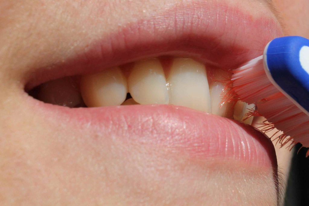 Lucariello Odontoiatria - Denti gialli bambini
